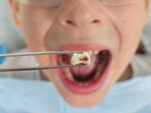 Best Pediatric Emergency Dentist in Garnet, CA